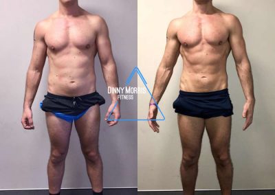 Before and After Weight Loss 3
